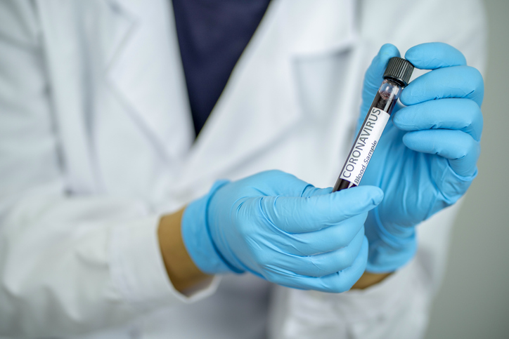 Blood Sample in a flask for analyzing Corona virus and producing vaccine. Corona virus outbreaking